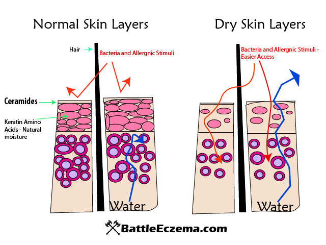 Ceramides and dry skin layers Diagram
