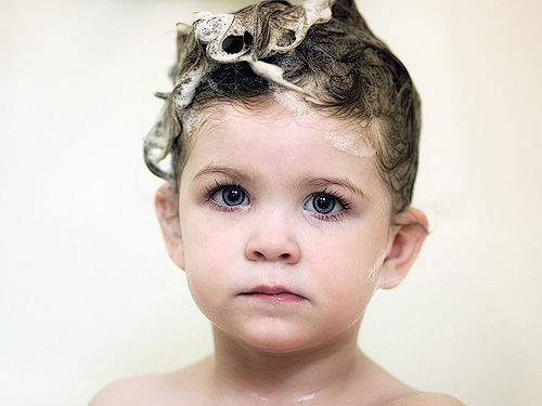 Sodium Lauryl Sulfate (SLS) ingredient in Shampoos.  Bad for Eczema?