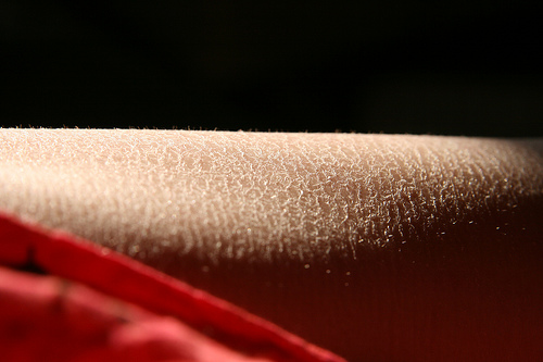 Skin care Tips for those with Dry Skin (Preventative)