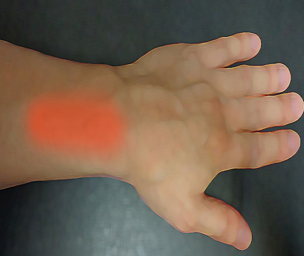 24-48 Hour Skin Sensitivity Test (New Products or Ingredients)