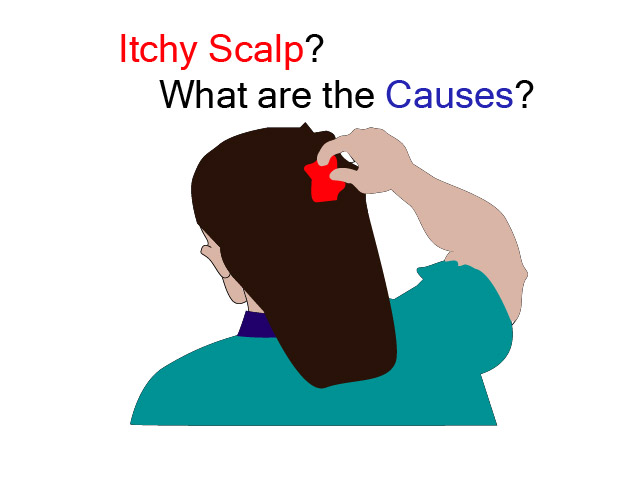 Itchy Scalp? What are the Causes and some Tips