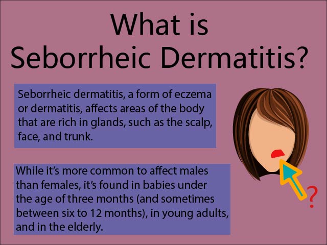 Seborrheic Eczema OurEczemaStory.com