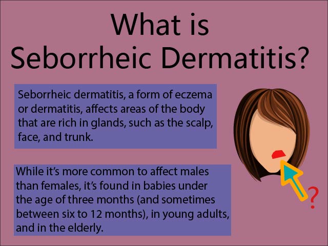 Whats Seborrheic Dermatitis Battle Eczema Holistic Way